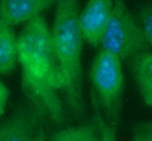 Human ARL5B Antibody (FITC Conjugate)