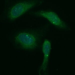 Human Amelotin Antibody (FITC Conjugate)