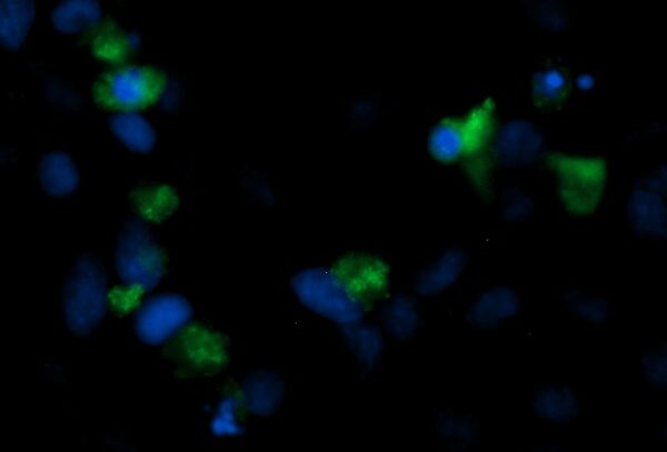 Human FGF1 Antibody (FITC Conjugate)