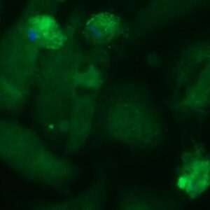 Human PARK7 (DJ-1) Antibody (FITC Conjugate)