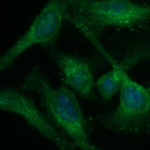 Human Alkaline Phosphatase (ALP) Antibody (FITC Conjugate)