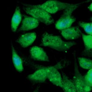 Human GM-CSF Antibody (FITC Conjugate)