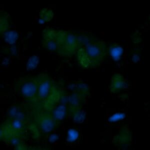 Human Lipoamide Dehydrogenase Antibody (FITC Conjugate)