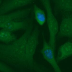 Human COL4A3BP Antibody (FITC Conjugate)