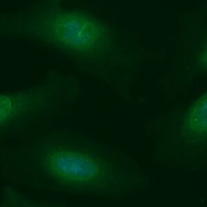 Human CBX1 Antibody (FITC Conjugate)