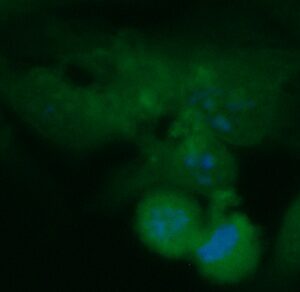 Human Creatine Kinase B-type  (CKBB) Antibody (FITC Conjugate)