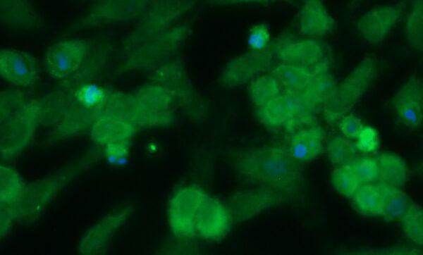 Human FKBP6 Antibody (FITC Conjugate)