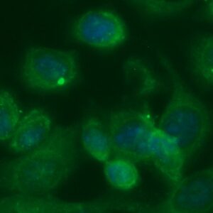 Human Diazepam Binding Inhibitor Antibody (FITC Conjugate)