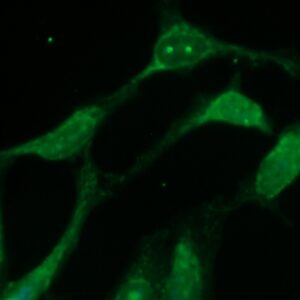 Human ALIX Antibody (FITC Conjugate)
