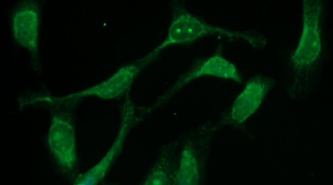 Human ALIX Antibody (FITC Conjugate)