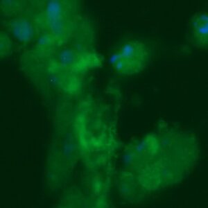Human ADP-ribosylation Factor 6 (ARF6) Antibody (FITC Conjugate)