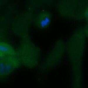 Human DPP4 Antibody (FITC Conjugate)