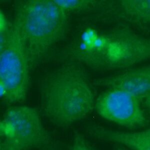 Human BAALC Antibody (FITC Conjugate)