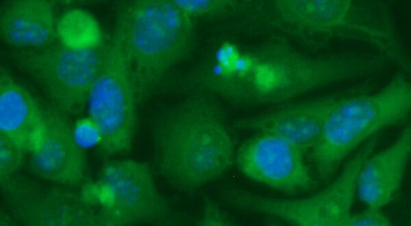 Human BAALC Antibody (FITC Conjugate)
