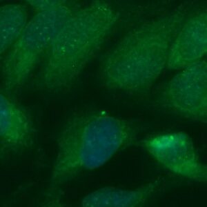Human ACAD8 Antibody (FITC Conjugate)