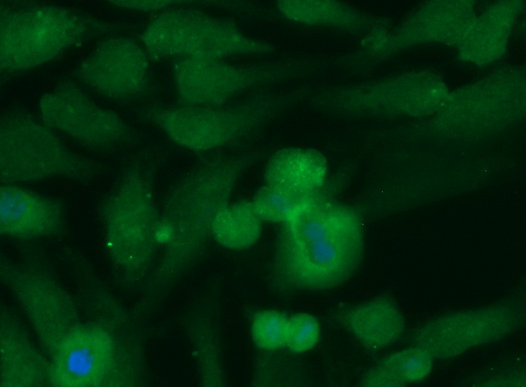 Human CRYZ Antibody (FITC Conjugate)