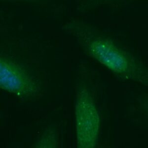 Human CAMK2N2 Antibody (FITC Conjugate)