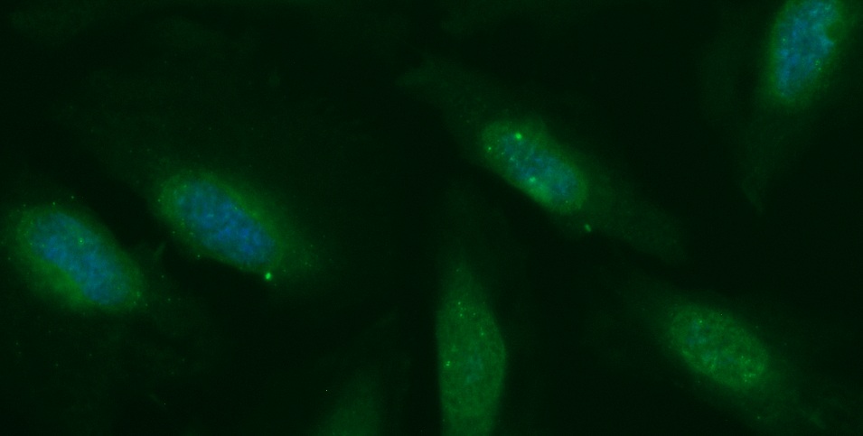 Human CAMK2N2 Antibody (FITC Conjugate)