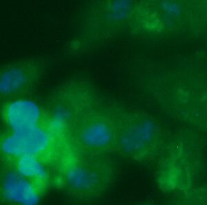 Human RhoGDI Antibody (FITC Conjugate)