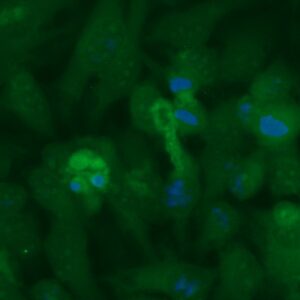 Human Macrophage inflammatory protein 5 Antibody (FITC Conjugate)