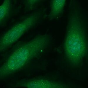 Human Calretinin Antibody (FITC Conjugate)