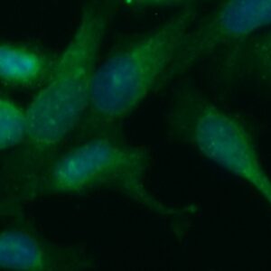 Human ACAA1 Antibody (FITC Conjugate)