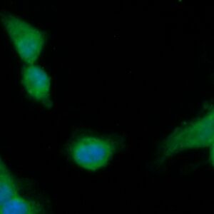 Human ECH1 Antibody (FITC Conjugate)