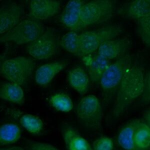 Human Amyloid Precursor Protein (APP) Antibody (FITC Conjugate)