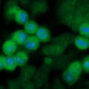 Human Calsequestrin 2 Antibody (FITC Conjugate)