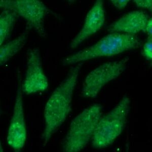 Human GMF beta Antibody (FITC Conjugate)