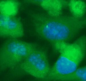 Human ARF5 Antibody (FITC Conjugate)