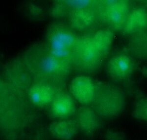 Human FKBP1B Antibody (FITC Conjugate)