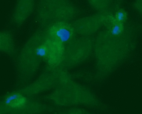 Human Ro Protein 52 kDA (Ro52) Antibody (FITC Conjugate) - Image 2