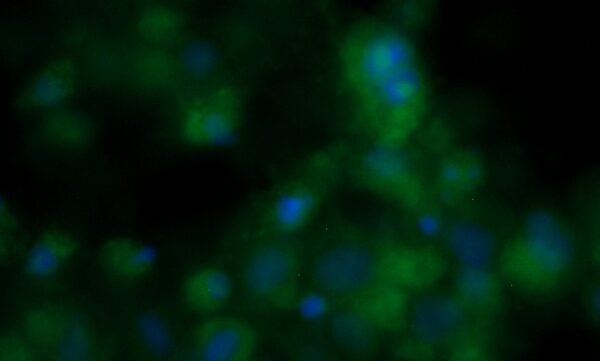 Human DNAJB8 Antibody (FITC Conjugate)