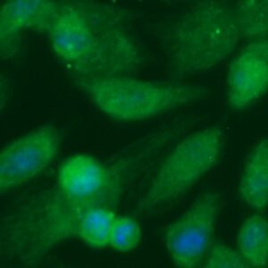 Human CRYGD Antibody (FITC Conjugate)