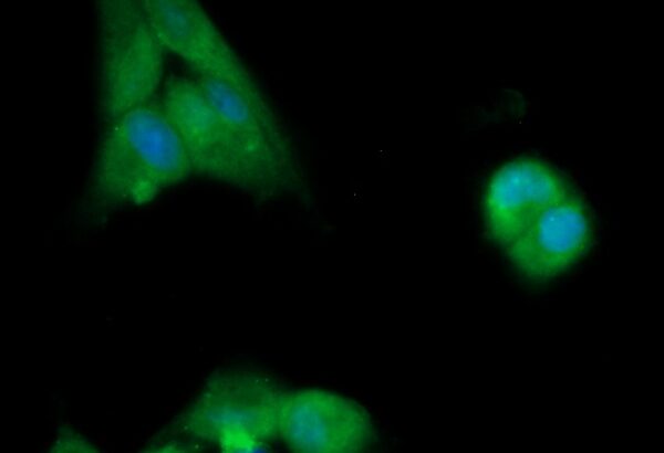 Human Ephrin B1 Antibody (FITC Conjugate)