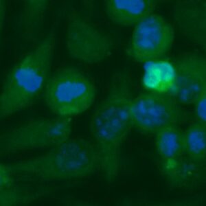 Human Carboxymethylenebutenolidase Homolog Antibody (FITC Conjugate)