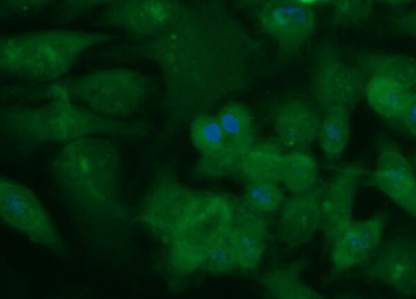 Human CHMP6 Antibody (FITC Conjugate)