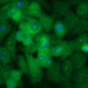 Human Carbonic Anhydrase 1 (CA1) Antibody (FITC Conjugate)