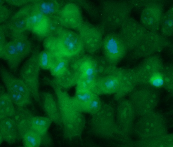 Human Carbonic Anhydrase 1 (CA1) Antibody (FITC Conjugate)