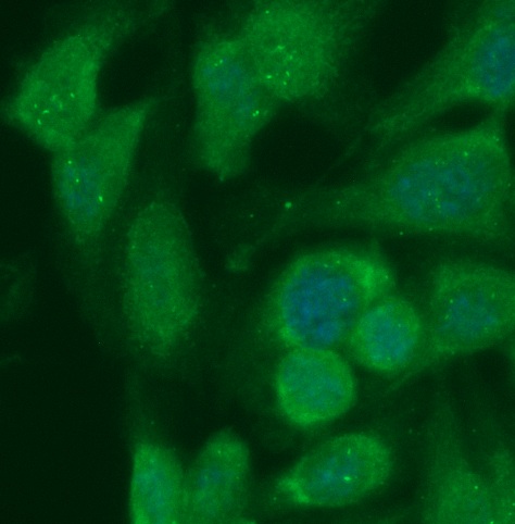 Human Acyl-coenzyme A Thioesterase 8 Antibody (FITC Conjugate) - Image 2