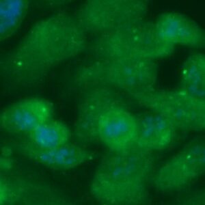 Human Creatine Kinase MT Antibody (FITC Conjugate)