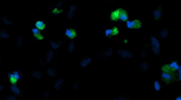 Human ESM1 AssayLite Antibody (FITC Conjugate)