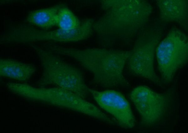 Human CAB39L Antibody (FITC Conjugate)