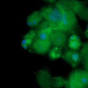 Human FBP2 Antibody (FITC Conjugate)