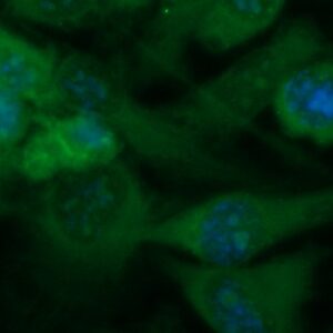 Human TAG-72 Antibody (FITC Conjugate)