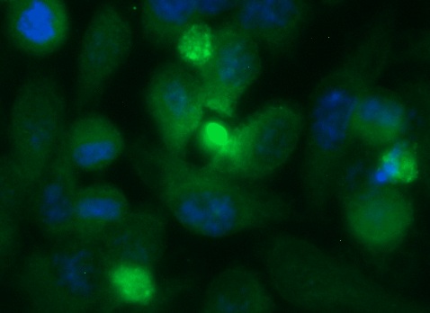 Human Thrombospondin 5 Antibody (FITC Conjugate)