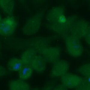 Human Liver Cytosolic Antigen Type 1 Antibody (FITC Conjugate)