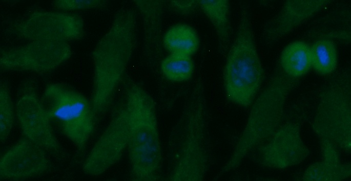 Human Cathepsin F (CTSF) Antibody (FITC Conjugate)