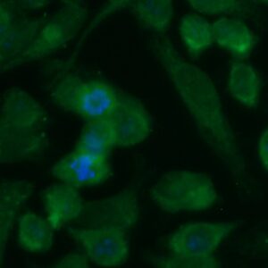 Human Cathepsin E (CTSE) Antibody (FITC Conjugate)